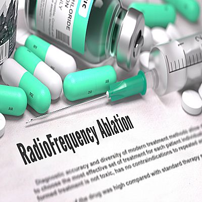 Radiofrequency Ablation